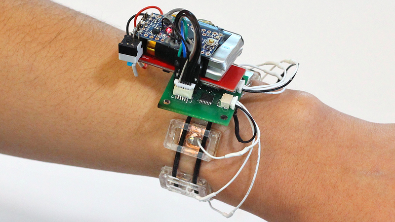 Illustration for article titled This Smartwatch Detects Gestures By Watching the Muscles Inside Your Arm Move